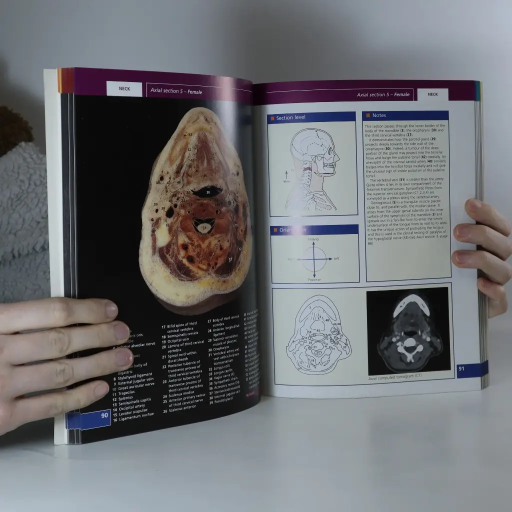 Atlas giải phẫu thiết đồ cơ thể người 