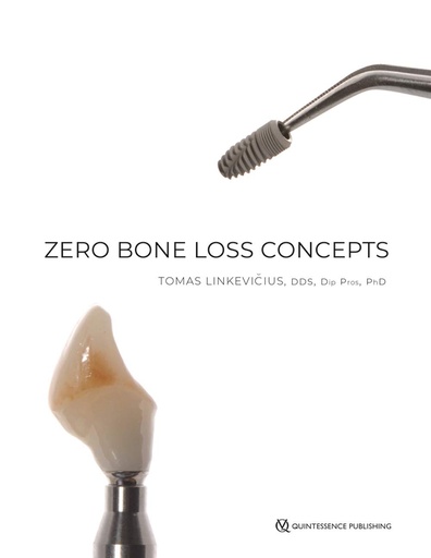 Zero Bone Loss Concepts 1E 316p