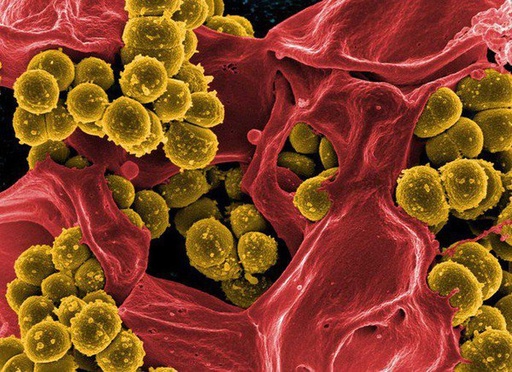 Điều trị nhiễm khuẩn huyết tụ cầu vàng - Staphylococcus Aureus 2025